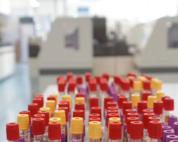 A Francoforte, otto casi di malaria: tre decessi nell'area aeroportuale