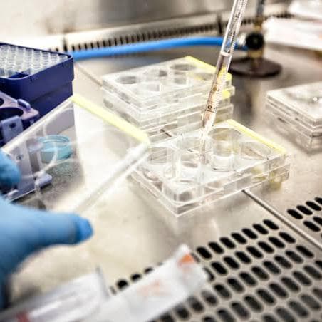 Possibile caso di Ebola in Trentino: analisi negative
